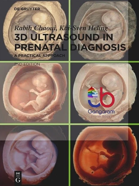 Book cover of '3D Ultrasound in Prenatal Diagnosis' with images of prenatal ultrasound scans.
